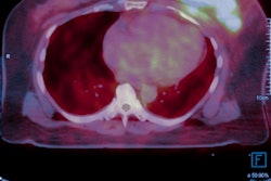 2020 09 15 20 25 8823 Pet Scan 400