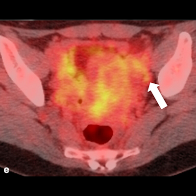 2021 09 01 16 44 9753 2021 09 01 Bjr Special Feature Image Image E 400