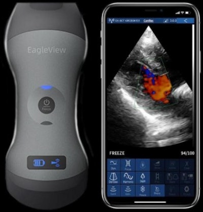 EagleView is a handheld wireless ultrasound probe for whole-body imaging. Image courtesy of EagleView Ultrasound.