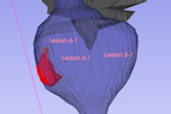 2021 09 07 22 24 6994 2021 09 07 Example Prostate Lesion Segmentation 20210907223223