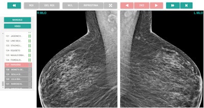 Example of mediolateral oblique projection magnification.
