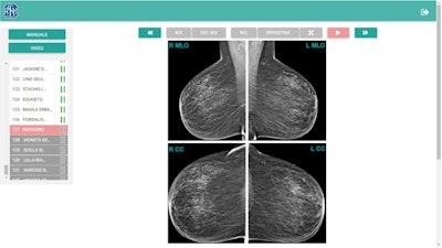 User interface of the self-evaluation test. Initial case presentation shows the four standard mammographic projections side by side. The left column allows the reader to browse through the 132 cases, identified with coded names. The toolbar at the top provides standard tools for image interpretation (brightness and contrast, magnification, drag) and classification (region of interest drawing and editing, case forward and back buttons). Figures courtesy of Dr. Beniamino Brancato and European Radiology.