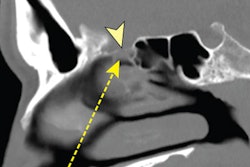 2021 09 17 15 02 2972 2021 09 09 Nejm Knizek Swab Injury 400