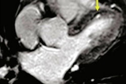 2021 09 24 00 27 9069 2021 09 23 Mri High Resolution Hearts C 400