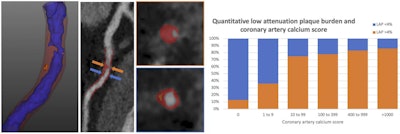 (Left) CTA plaque analysis showing lumen in blue, noncalcified plaque in red and low-attenuation plaque (LAP) in orange. (Right) LAP increases as the calcium score increases but is common in symptomatic patients with zero or low calcium score. All images courtesy of SCOT-HEART trial.