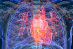 2020 01 04 00 31 7725 Heart Attack Disease 3 D 400