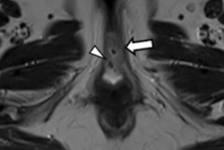 2021 10 01 21 56 4515 2021 10 04 Mri New Guides Vulvar Cancer Figure5 20211001214125