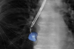 2021 10 07 20 39 1732 2021 10 07 3 D Lung Biopsy 20211007200049