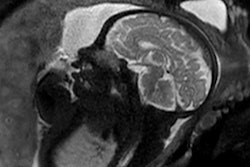 2021 10 08 16 19 7132 2021 10 08 Jfr Contrast Agents Image