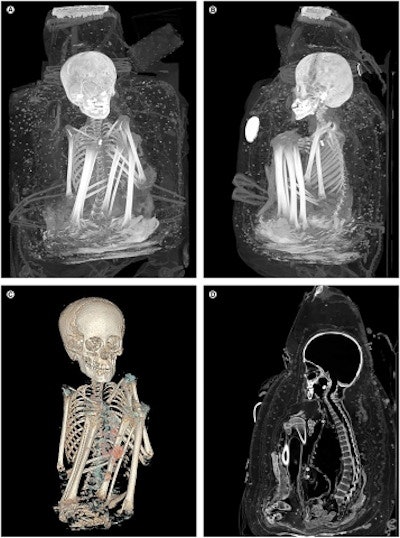 The last example concerns a packaged mummy with a so-called false head, from the Museum of Cultures in Basel
