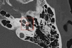 2021 10 13 19 48 7003 2021 10 14 Jfr Ai Otology Figure2 400