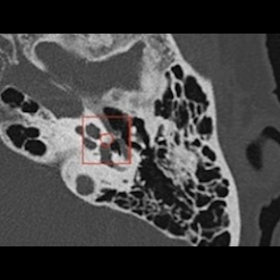 2021 10 13 19 48 7003 2021 10 14 Jfr Ai Otology Figure2 400