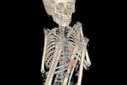 2021 10 14 14 51 0728 2021 10 11 Jfr Story 2 Mummies Figure5 Image C 400