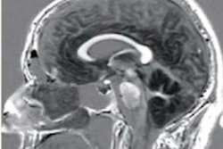 2021 10 15 19 11 6602 2021 10 14 Mri Low Field 20211015191105