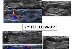 2021 10 19 15 18 5318 2021 10 20 Ultrasound Covid Adenopathy Figure2 20211019154110