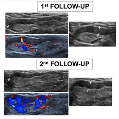 2021 10 19 15 18 5318 2021 10 20 Ultrasound Covid Adenopathy Figure2 20211019154110