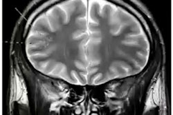 2021 10 20 16 19 8134 2021 10 21 Jfr 21 Psychiatric Imaging Screenshot2 400