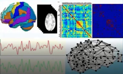 Resting-state functional MRI is acquired in the absence of a stimulus or a task. Courtesy of Dr. Sidney Krystal and JFR 2021.