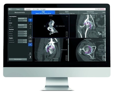 Naviplan is a digital preoperative planning application for orthopedic surgeons. Image courtesy of Naviswiss.