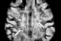 2021 10 23 00 27 2034 2021 10 25 Bydder Low Field Image2 400