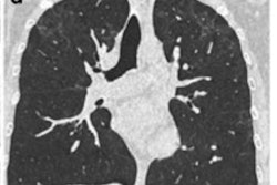 2021 11 01 21 40 3075 2021 11 02 Statement On Covid Pneumonia Figure5 D 400