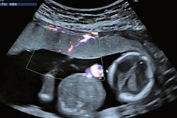 2021 11 05 15 31 2887 2021 11 05 London Ultrasound Hifu Doppler 400
