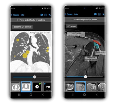 The app's colored overlays show specific features of case images. All images courtesy of Dr. Kay-Geert Hermann.