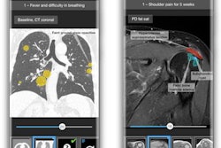 2021 11 05 21 02 9788 2021 11 08 Berlin Case Viewer Android Pulmo And Shoulder White 20211105211802