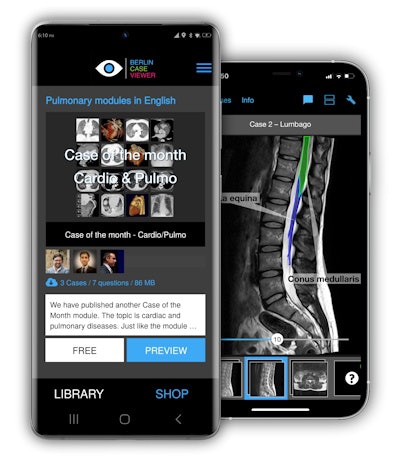 Collaboration with Romanian and Pakistani IT teams has allowed the app's technology to be transferred to a smaller screen.