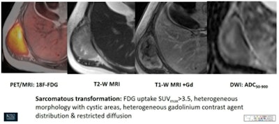 Integrated PET/MRI offers both synchronicity and synergism.