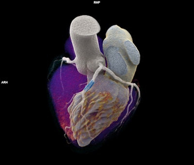 Naeotom Alpha's dual-source temporal resolution supports scanning of patients at any heart rate, while the photon-counting detector enables spectral information and high resolution, according to the vendor.