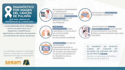 Image courtesy of SERAM.