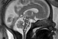 2021 11 30 16 43 7534 2021 11 30 Rsna Fetal Brain Mri 20211130160353