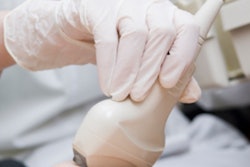 2016 11 01 16 42 02 992 Ultrasound Exam Transducer 400