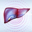 2021 12 11 00 36 5129 Liver Gallbladder 400