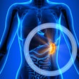 2021 12 20 18 03 0967 Spleen2 400