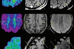 2022 01 06 16 56 7740 2022 01 05 Mri Brain Changes Figure3 20220106161515