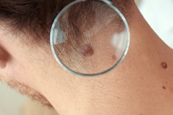 2022 01 13 00 38 1166 Physical Exam Cancer Head And Neck 400