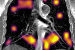 2022 01 31 22 13 8909 2022 02 01 Oxford Long Covid 20220131225312