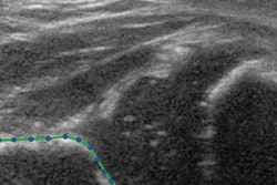 2022 02 02 21 29 4629 2022 01 26 Rsna Ultrasound Hip