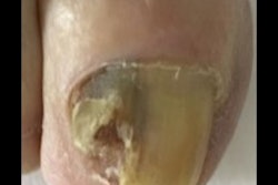 2022 02 08 00 40 0333 2022 02 08 Ultrasound Nails Slide2 Images 400