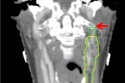 2022 02 09 19 41 9445 2022 02 10 Head And Neck Cancer Figure 2 20220209195426