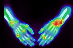 2022 02 16 16 55 6126 2022 02 16 Pet Rheumatoid Arthritis 400