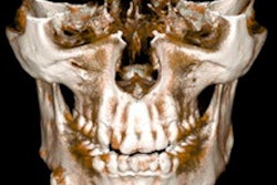 2022 02 18 22 51 2954 2022 02 21 Cinematic Rendering Image D 400