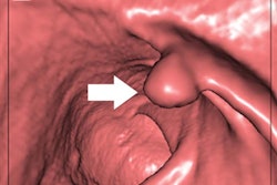 2022 02 23 18 50 5762 2022 02 23 Ai Ctc Figure B