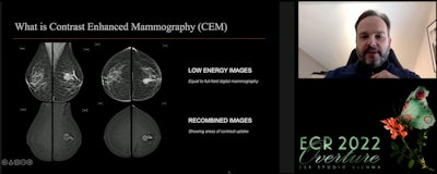 Dr. Marc Lobbes, PhD, vouched for contrast-enhanced mammography's advantages over breast MRI at the ECR Overture on 2 March. Lobbes focused on this method's performance in comparison to MRI, as well as efficiency in patient imaging times and machine costs for facilities.
