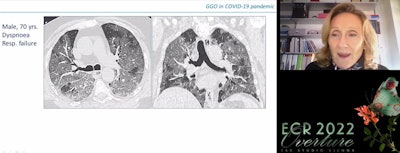 Dr. Anna Rita Larici of the Catholic University of Sacro Cuore in Rome, Italy, presenting on 2 March at ECR 2022 Overture.