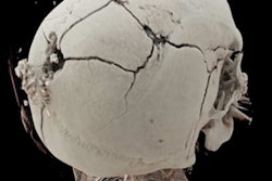 2022 03 16 20 05 6689 2017 03 02 Forensic2 400