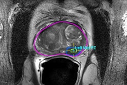 2022 03 16 22 19 0157 2022 03 16 Bjr Prostate 400