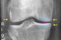 2022 03 21 04 54 6618 2022 03 18 Oa Knees 20220321043936